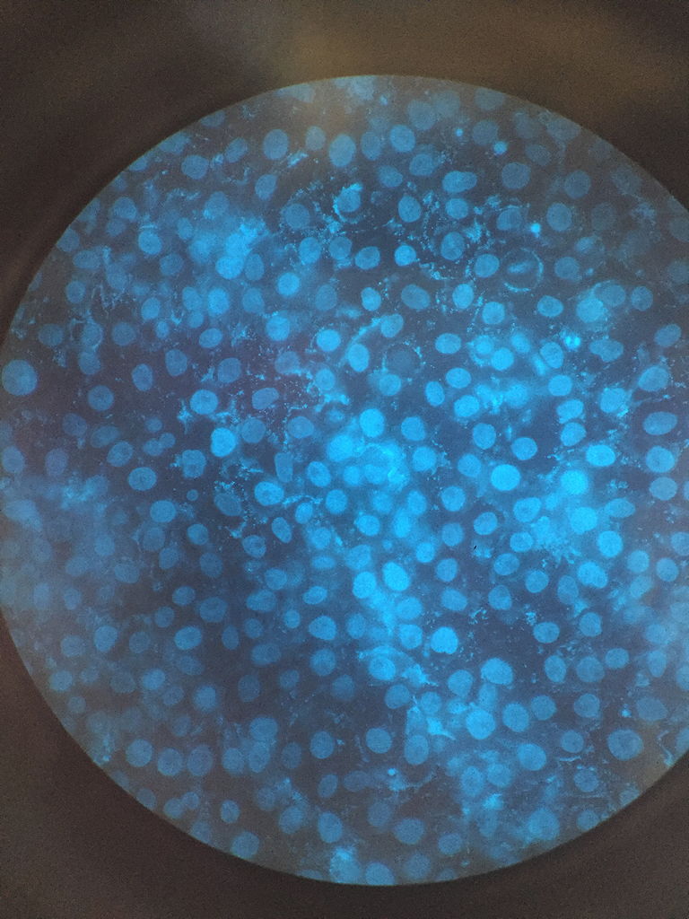 Fluoreszenzmikroskopie mit Mi­totrackerfärbung