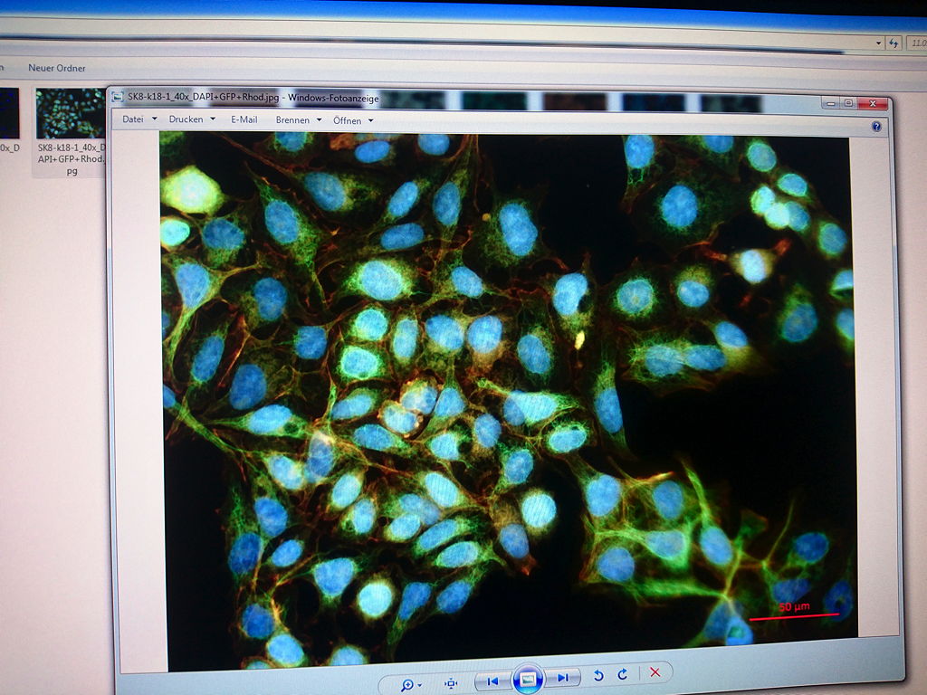 Zellen mit fluoreszierenden Farbstoffen
