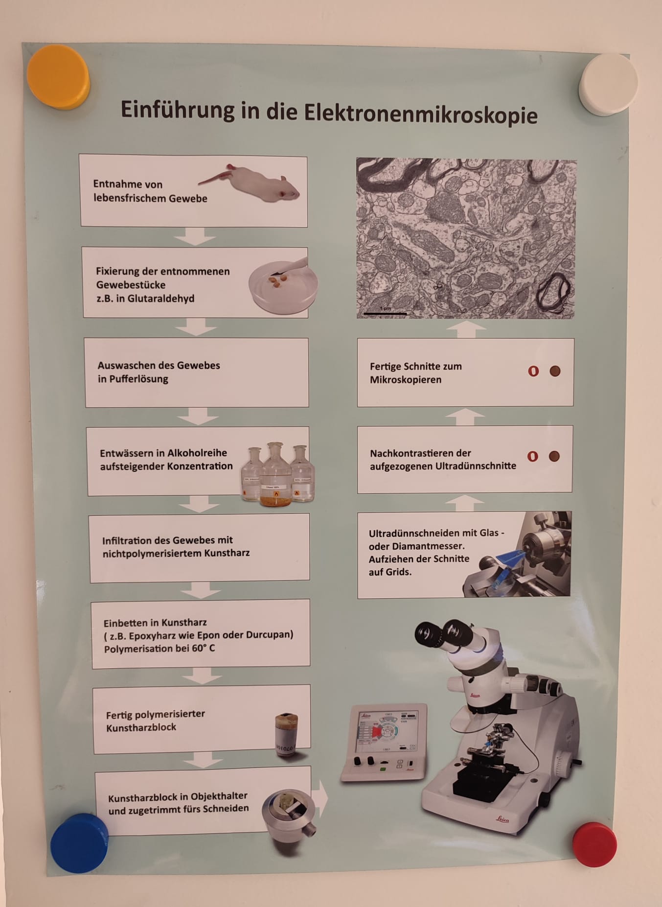 Ablauf Elektronenmikroskopie